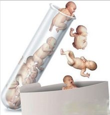21三体综合征（唐氏综合症）和三代借卵做试管婴儿技术